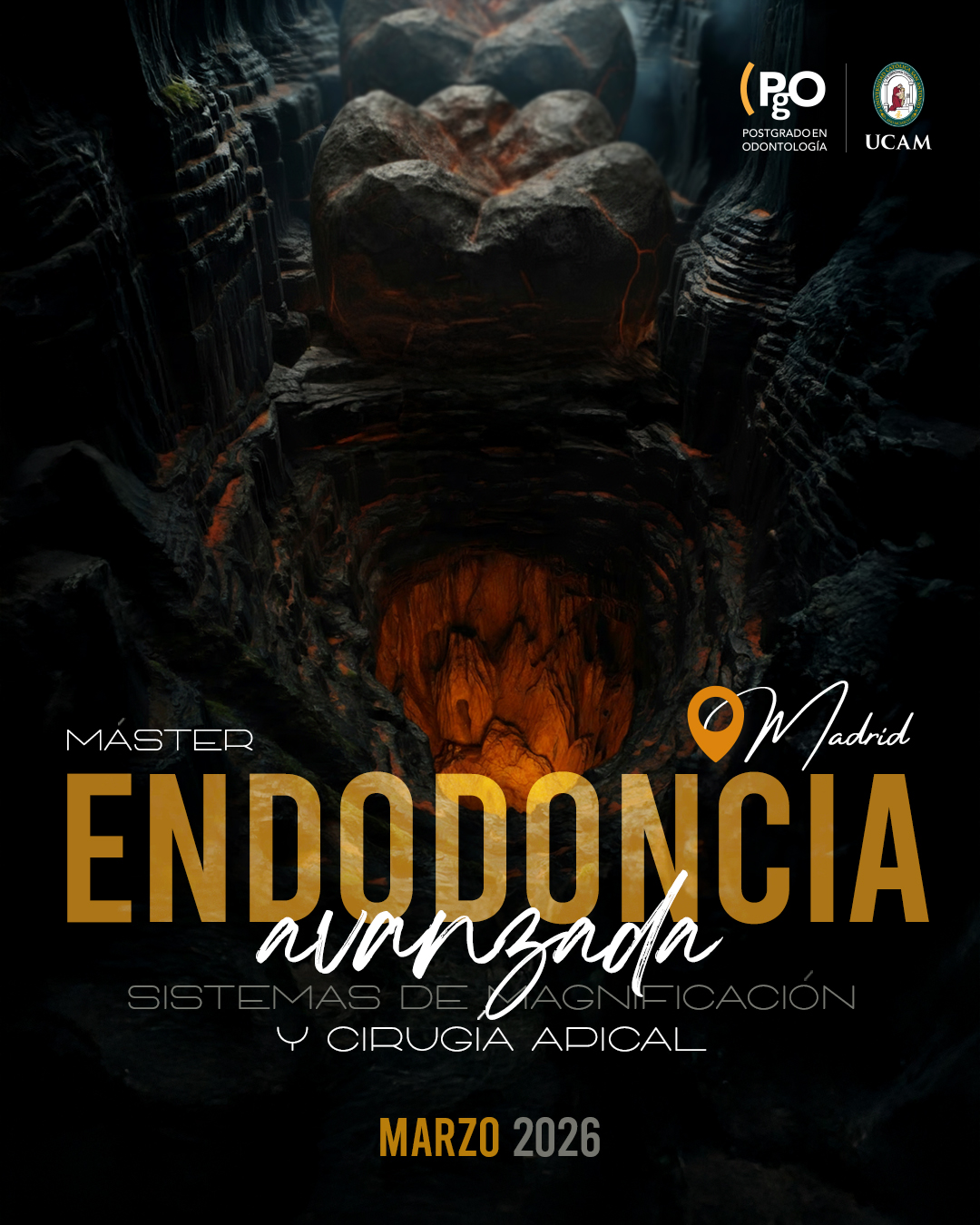 imagen del minicurso Endodoncia Avanzada, Sistemas de Magnificación y Microcirugía Apical